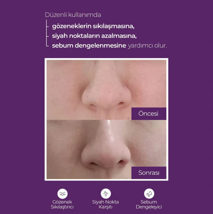 Superyou Peeling Etkili Kapsül Tonik - Gözenek Sıkılaştırma, Ölü Hücrelerden Arınma, Leke Karşıtı